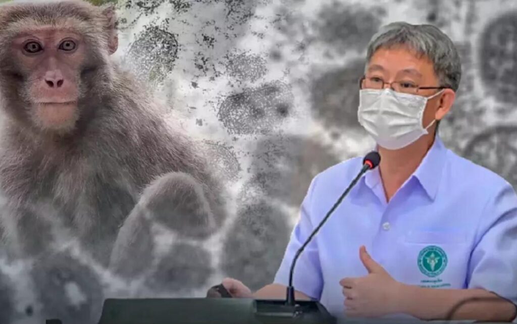 Une Thaïlandaise confirmée comme 5e cas de variole du singe en Thaïlande