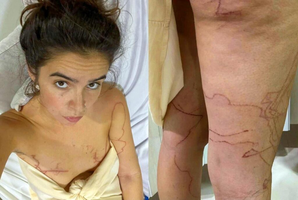 Thaïlande : méduses et autres dangers, conseils pour se baigner en toute sécurité