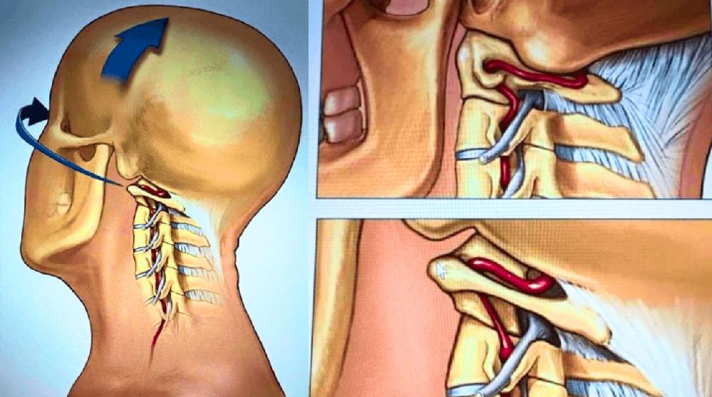 Thaïlande : une chanteuse meurt après 3 massages thaïlandais