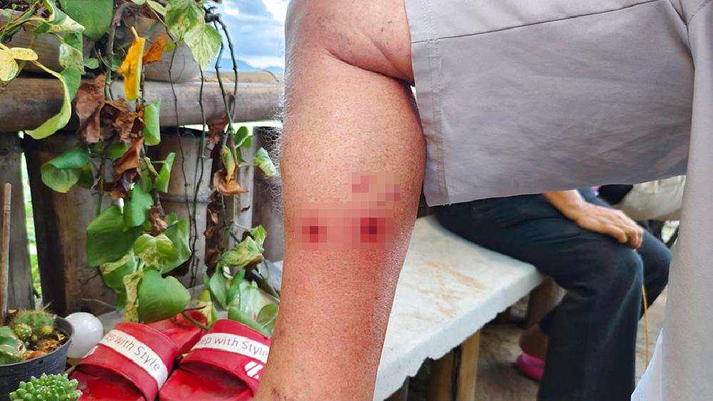 Thaïlande : les chiens agressifs d'un expatrié suisse attaquent de nouveau