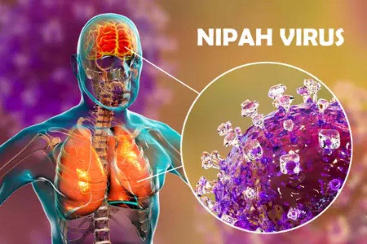 Les destinations touristiques de Thaïlande en alerte face au virus Nipah 6 Zones du corps touchées par le virus Nipah