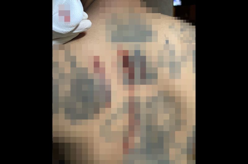 Thaïlande : il teste le pouvoir de ses tatouages sacrés et finit blessé à la hache 6 Le dos tatoué de l’homme présente plusieurs entailles après le rituel