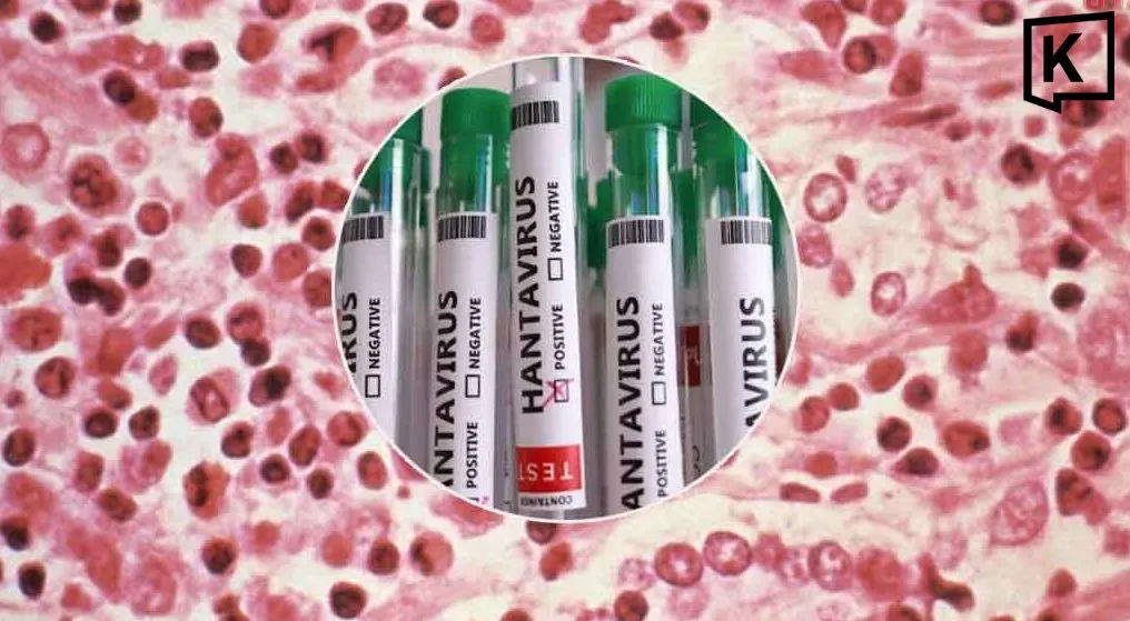 Tubes de test du hantavirus