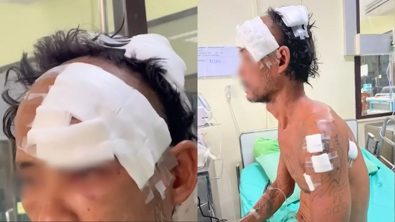 Thaïlande : un homme survit à l’attaque d’un ours grâce à un cri strident