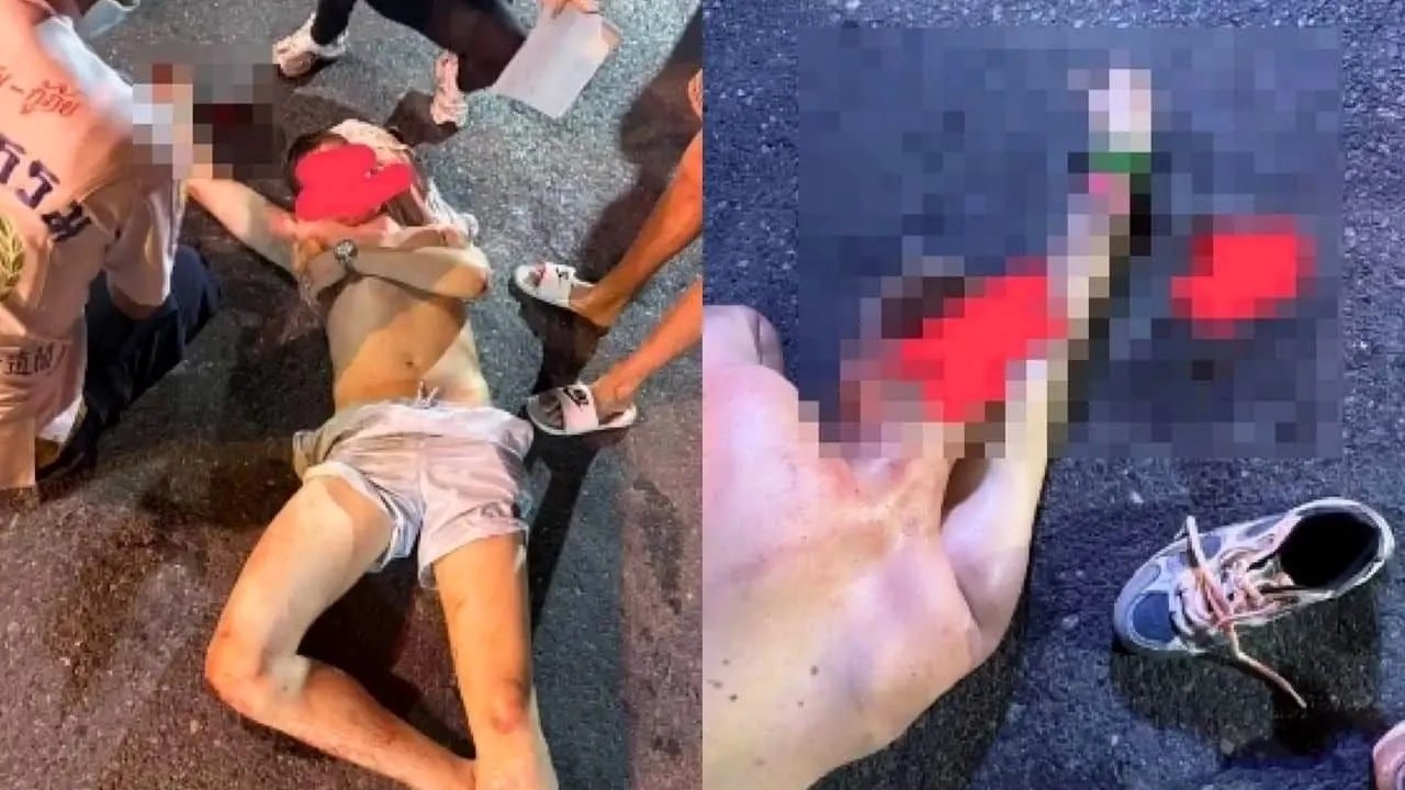 Le boxeur britannique Colin Cairney grièvement blessé après sa chute d'un tuk-tuk à Patong, Phuket